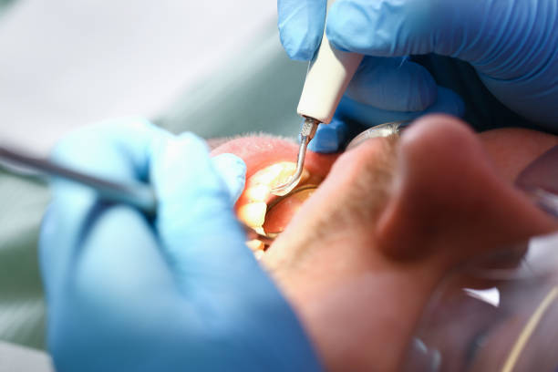 Best Dentist for Tooth Abscess  in Sanatoga, PA